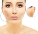 הסרה בטוחה של פיגמנטציה לסוגיה-תמונה